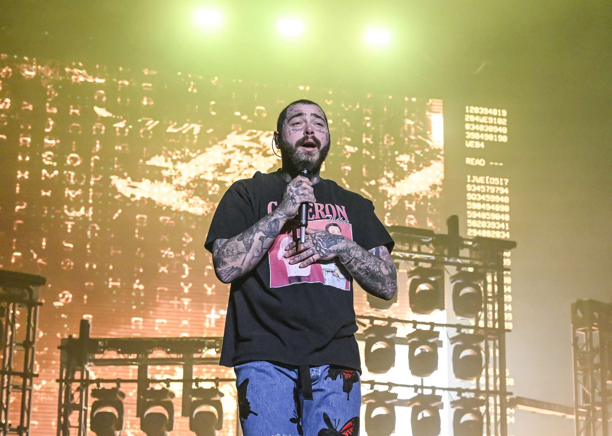 Post Malone’s Injury Is Getting Worse: Cancels Concert 1 Week After Accident